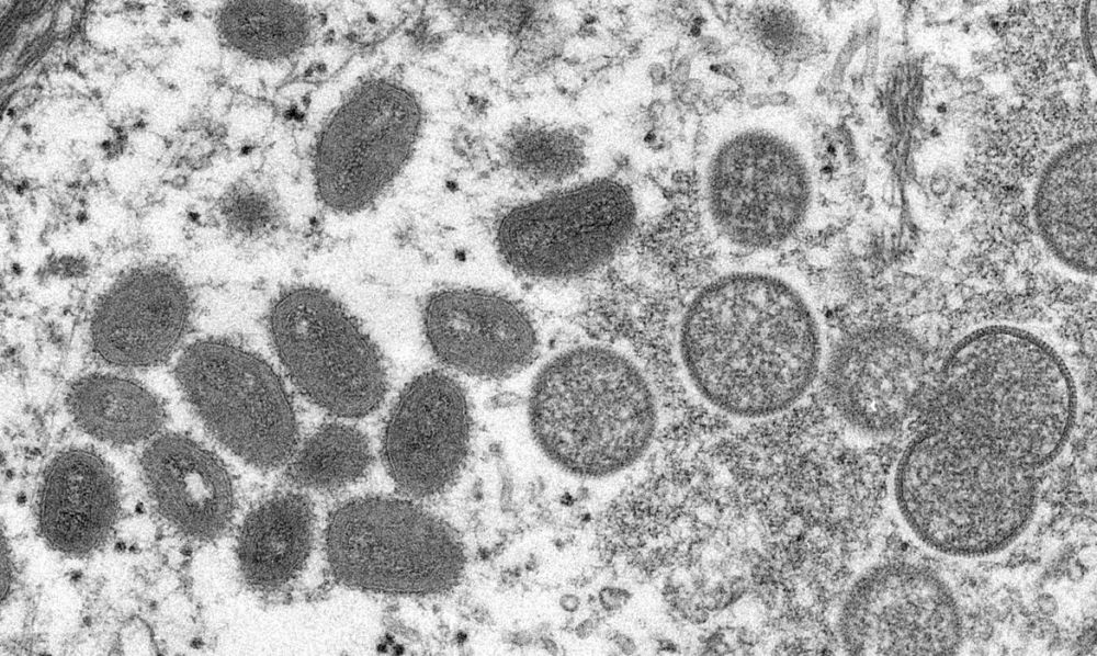 Saúde monitora sete casos suspeitos de varíola dos macacos